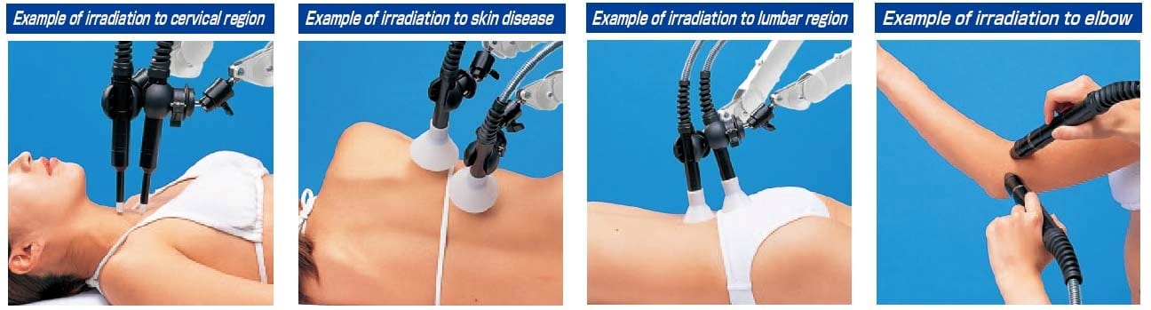 Example of irradiation